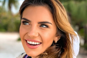 Sonia z "Hotelu Paradise" ściągnęła aparat