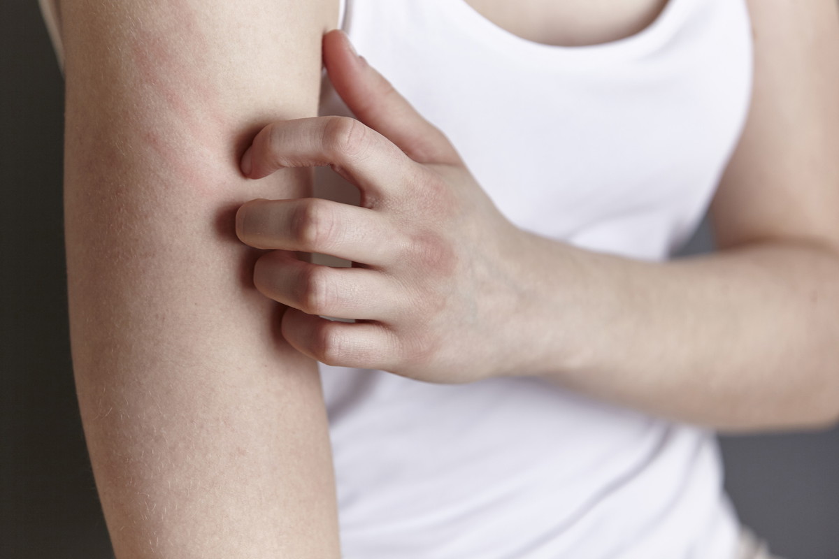 Alergia skórna