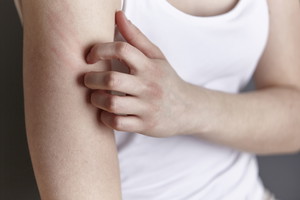 Alergia skórna