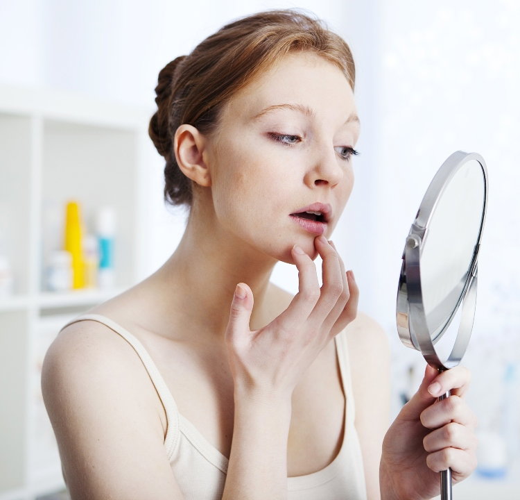opryszczka1