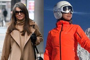 Kinga Rusin pokazała zdjęcie twarzy po wypadku na nartach: "No dobra, trochę przesadziłam"