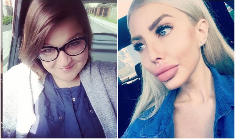 Dominika Gwit, Anella