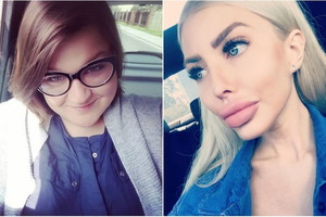 Dominika Gwit, Anella