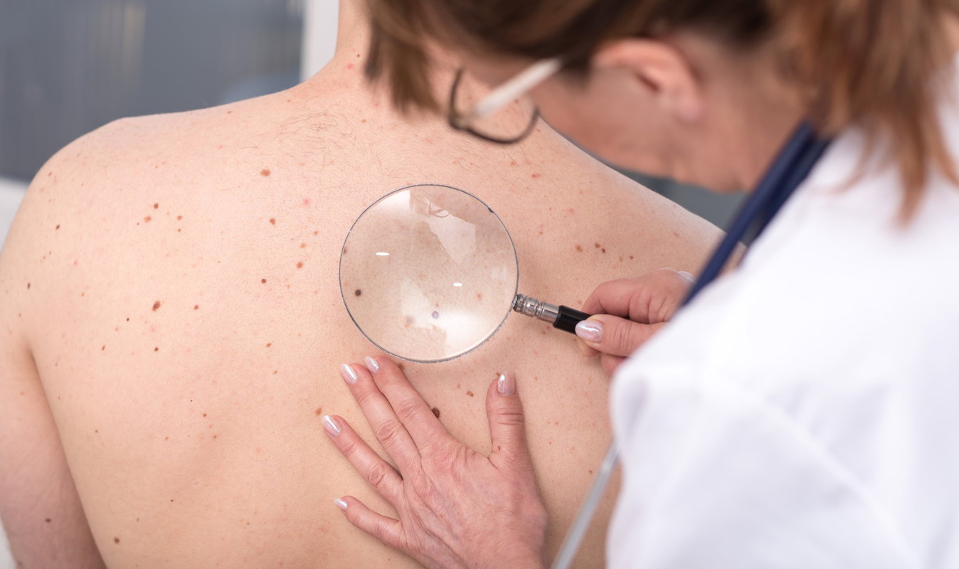 dermatolog-ogladajacy-skore-pod-mikroskopem