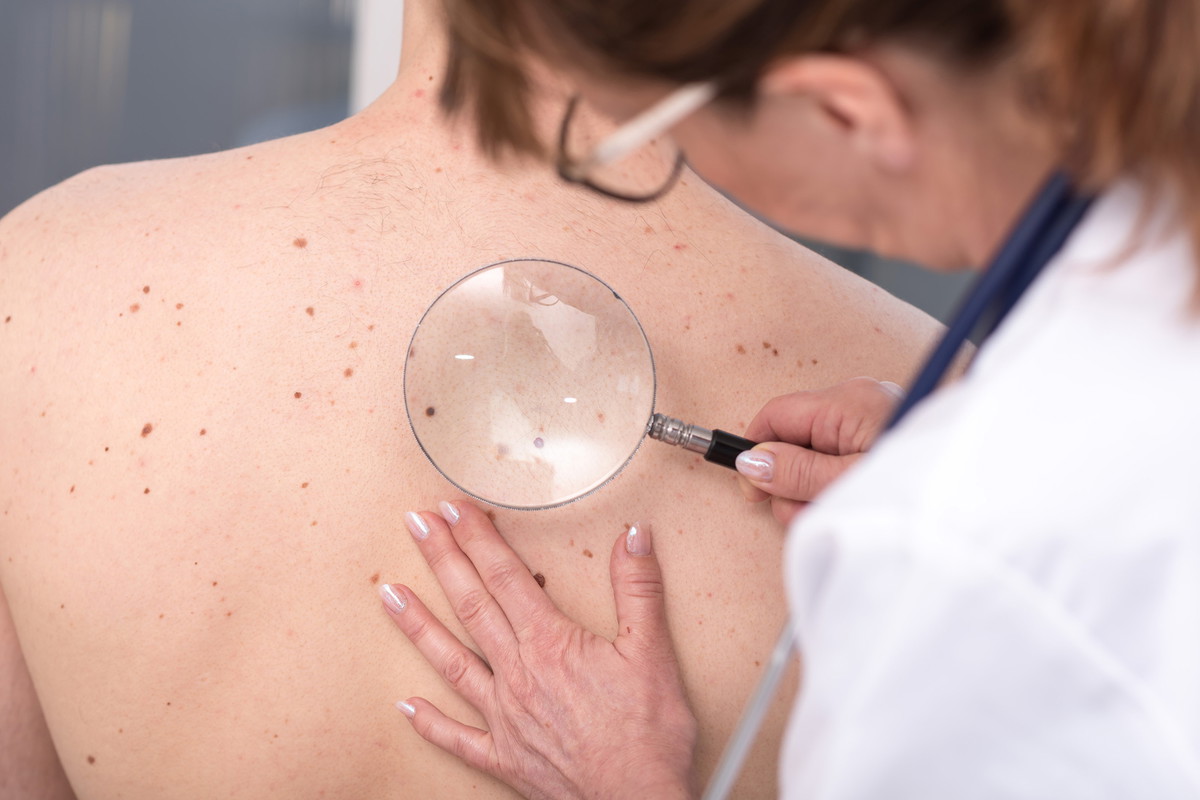 dermatolog-ogladajacy-skore-pod-mikroskopem