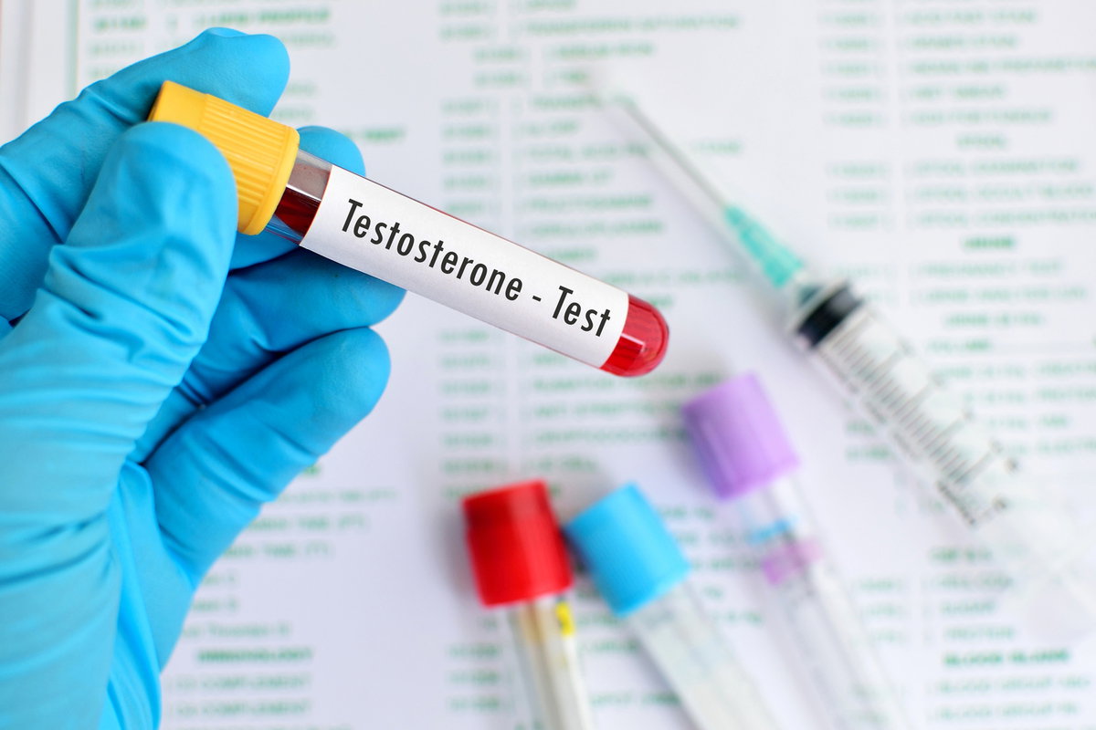 Badanie poziomu testosteronu