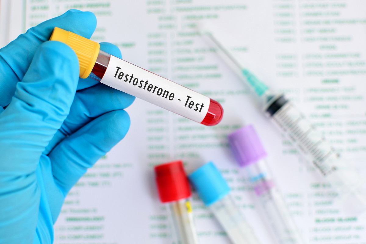 Badanie poziomu testosteronu