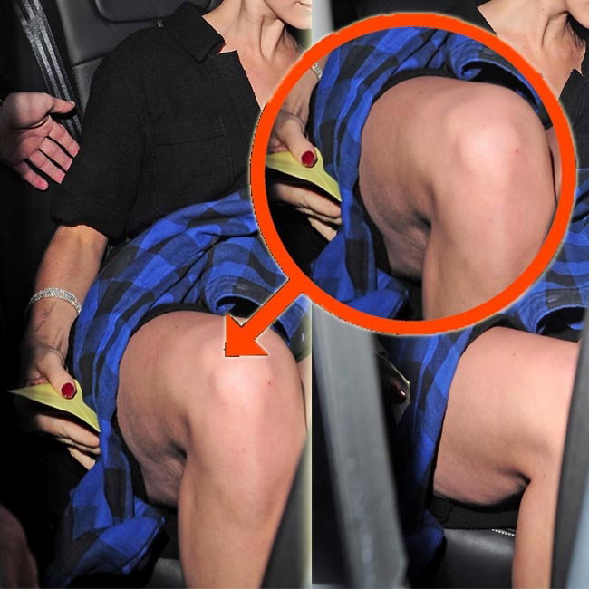 Lana Del Rey cellulit