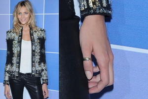 Anja Rubik nosi obrączkę na kciuku!