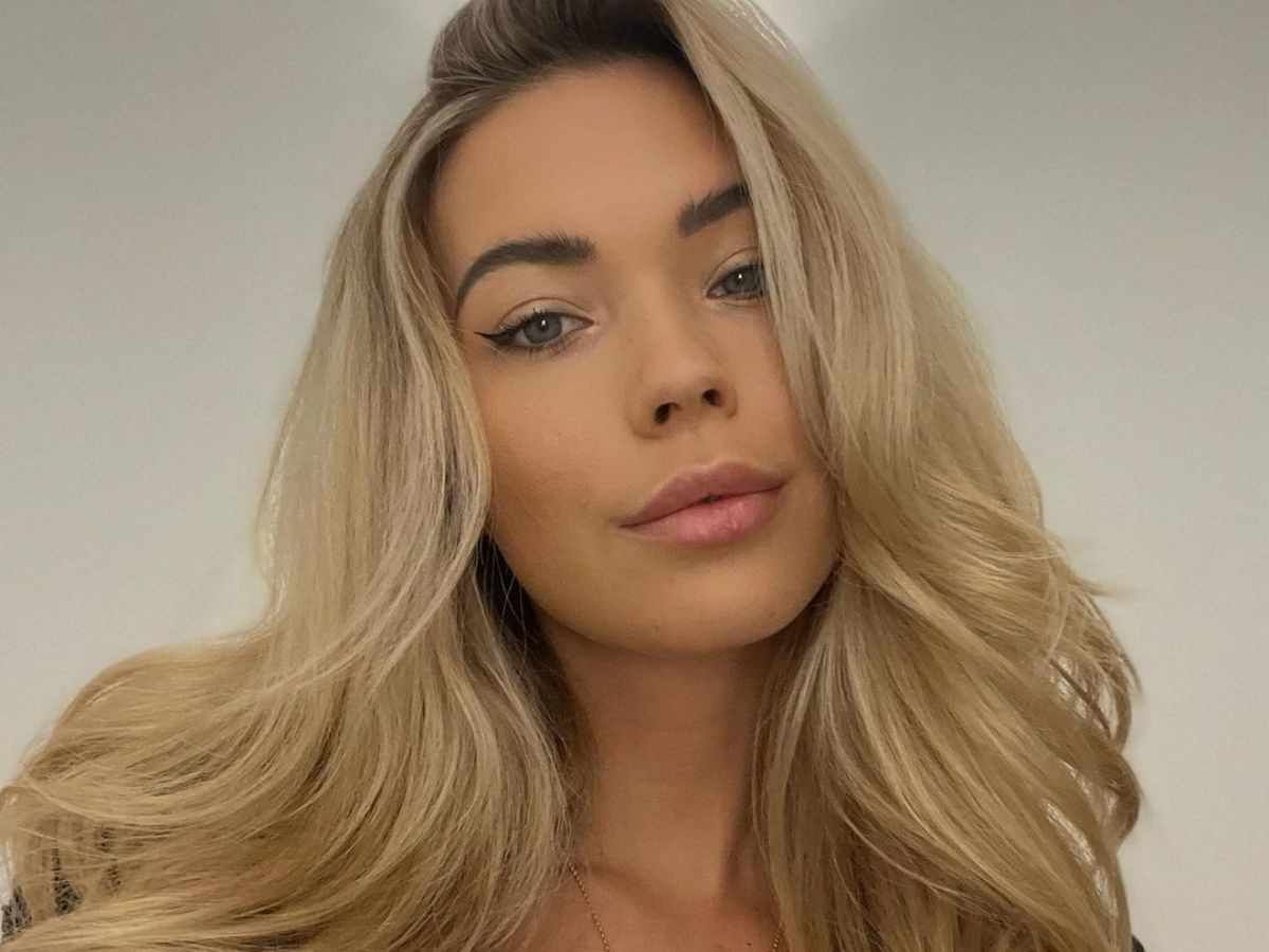 Sandra Kubicka cierpi na nietypową przypadłośc