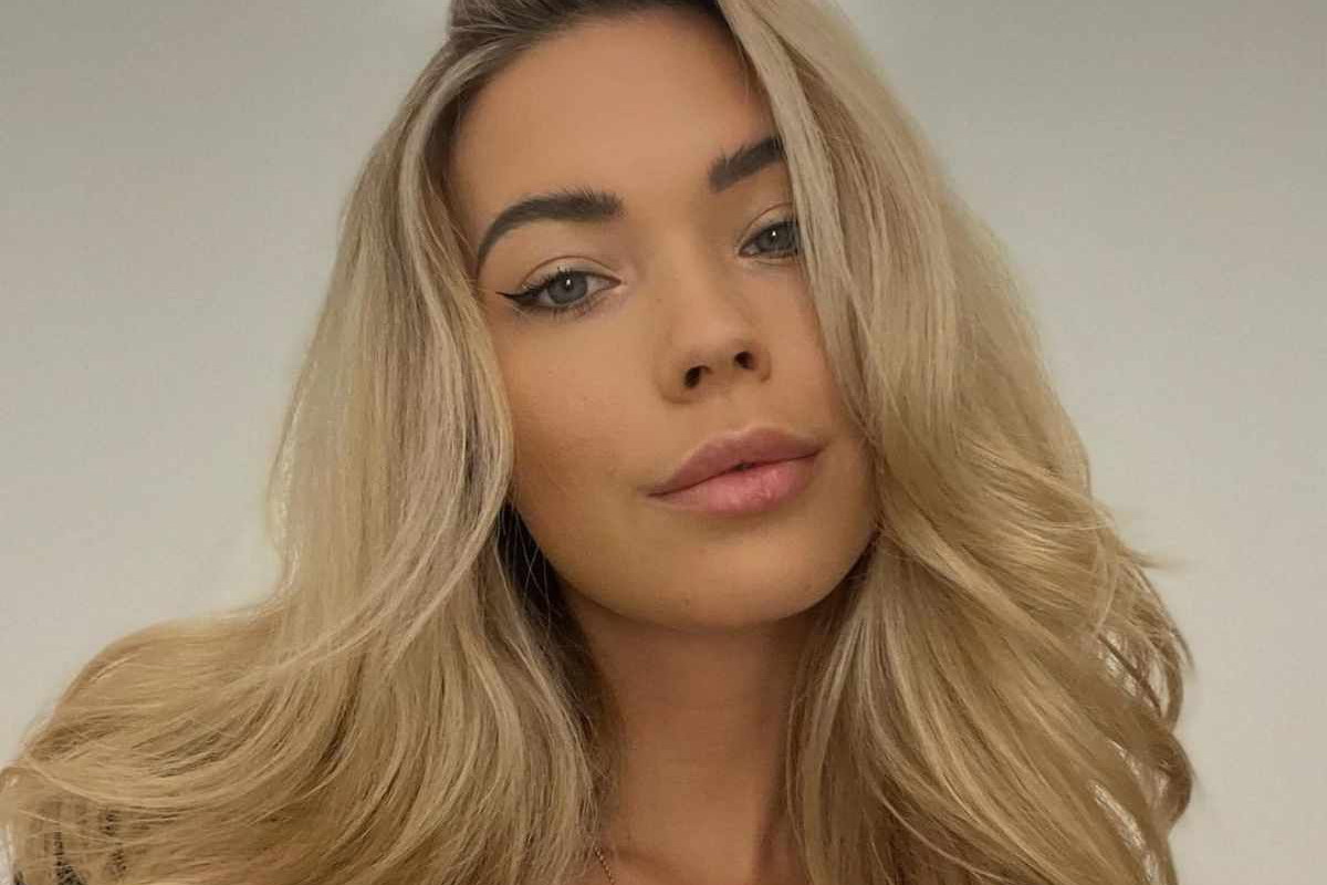 Sandra Kubicka cierpi na nietypową przypadłośc