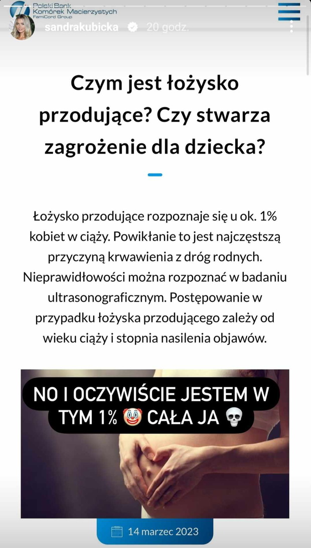 Sandra Kubicka cierpi na nietypową przypadłość