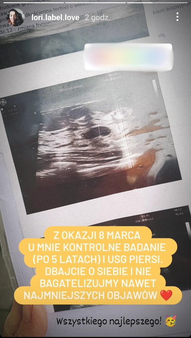 Laura ze "Ślubu od pierwszego wejrzenia"