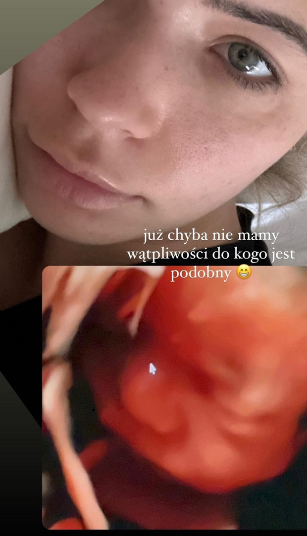Sandra Kubicka pokazała USG