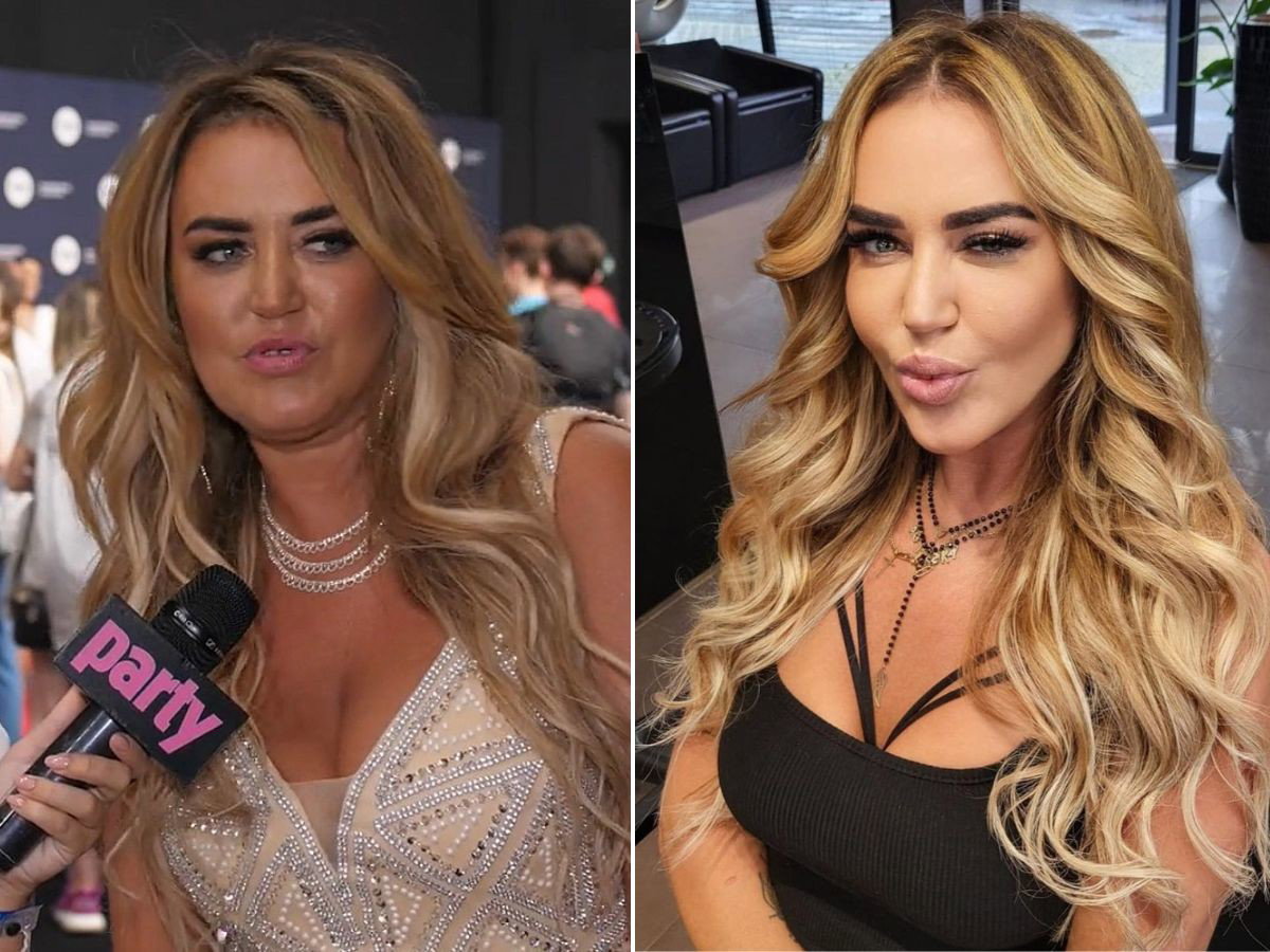 Gogglebox Agnieszka Kotońska o operacjach plastycznych