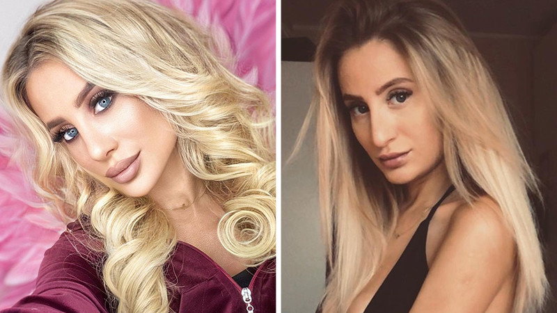 Ania Adamczyk z "Hotelu Paradise" o operacji nosa