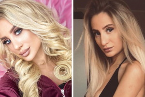 Ania Adamczyk z "Hotelu Paradise" o operacji nosa