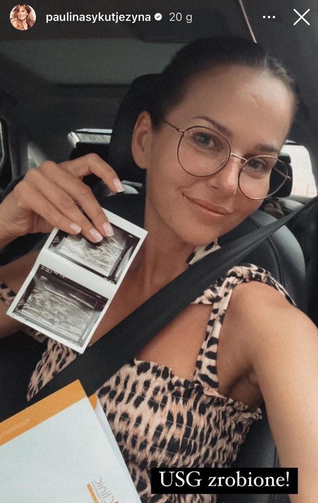 Paulina Sykut-Jeżyna usg