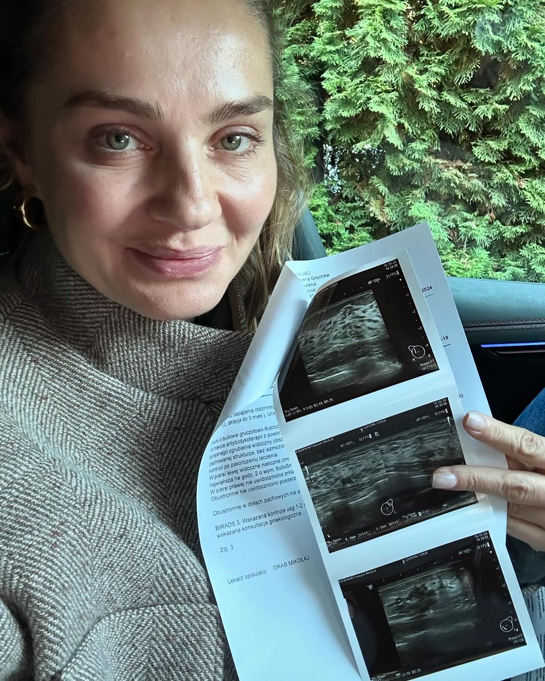 Małgorzata Socha pokazała zdjęcie z USG