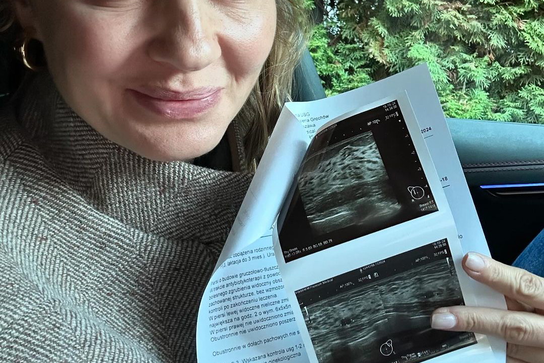Małgorzata Socha pokazała zdjęcie z USG