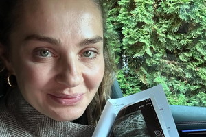 Małgorzata Socha pokazała zdjęcie z USG