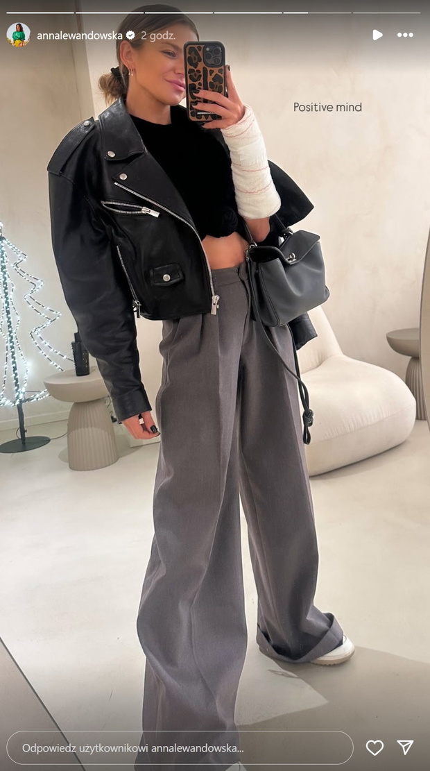 Anna Lewandowska kontuzja