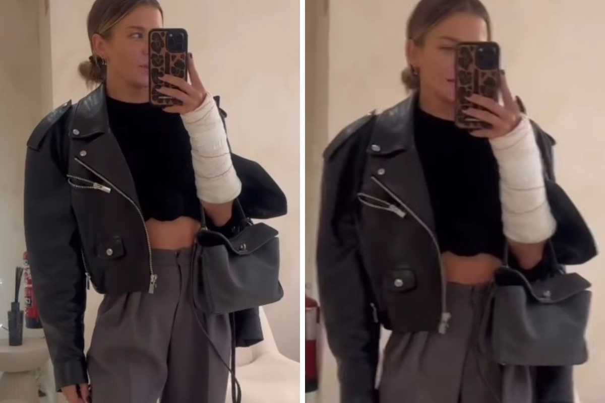 Anna Lewandowska kontuzja