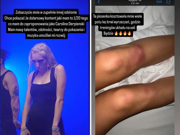 Caroline Derpienski o swojej nowej piosence
