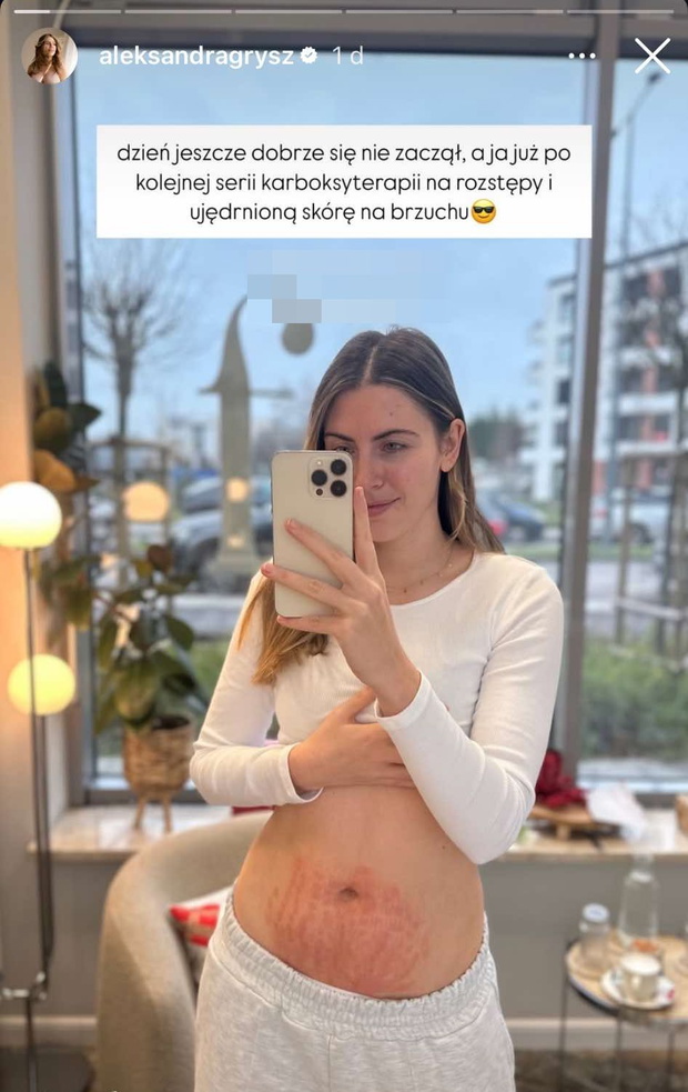 Aleksandra Grysz pokazała brzuch po ciąży