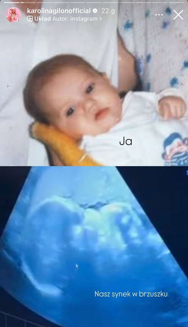 Karolina Gilon pokazała zdjęcie syna