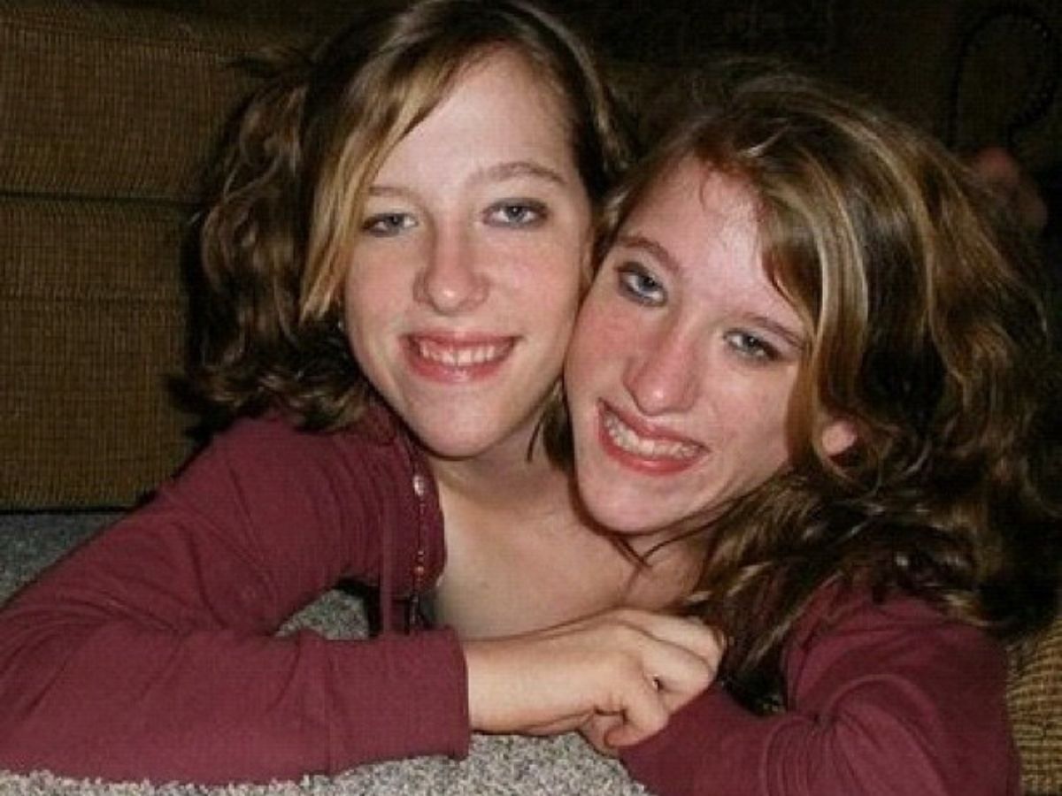 Abby i Brittany Hensel