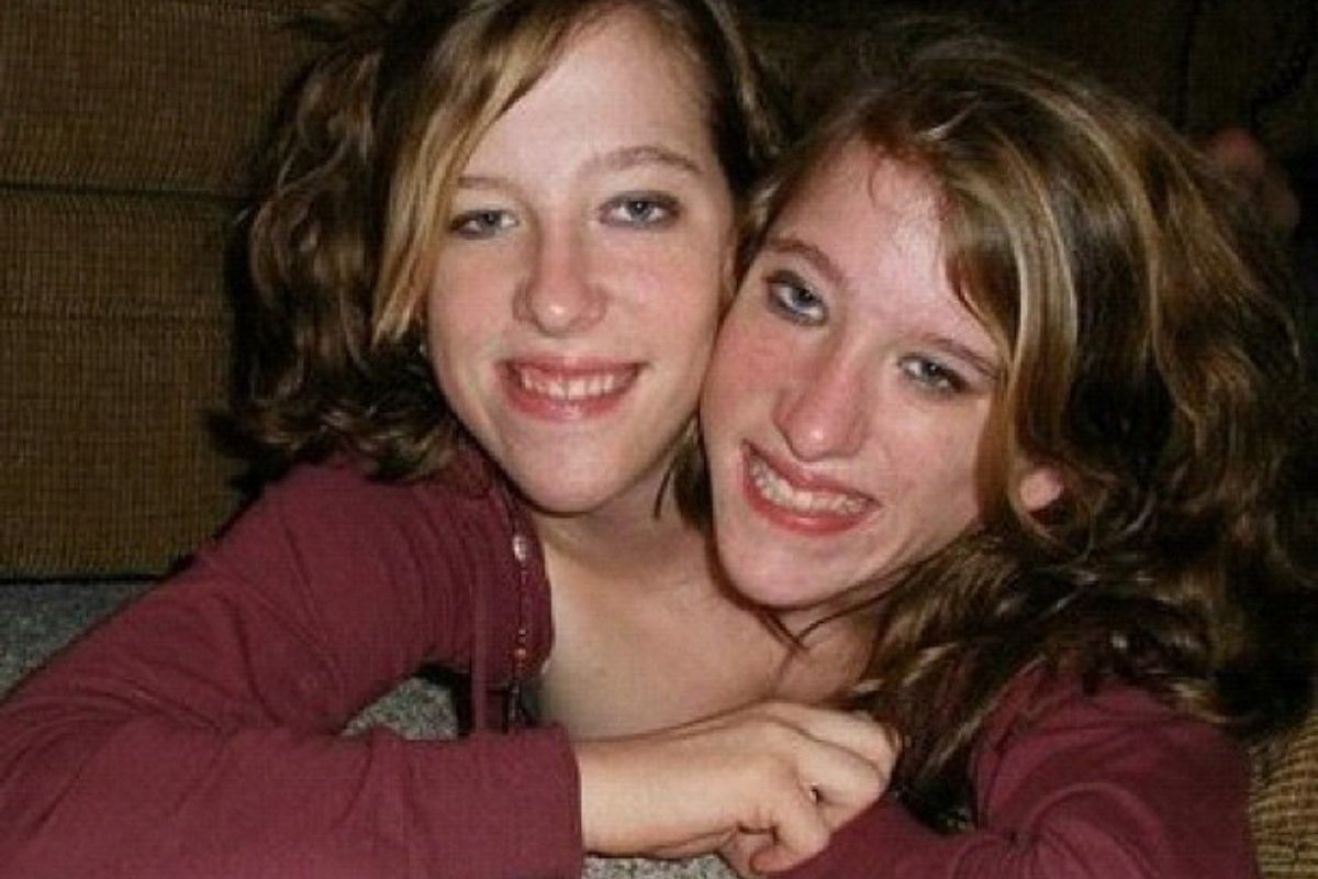 Abby i Brittany Hensel