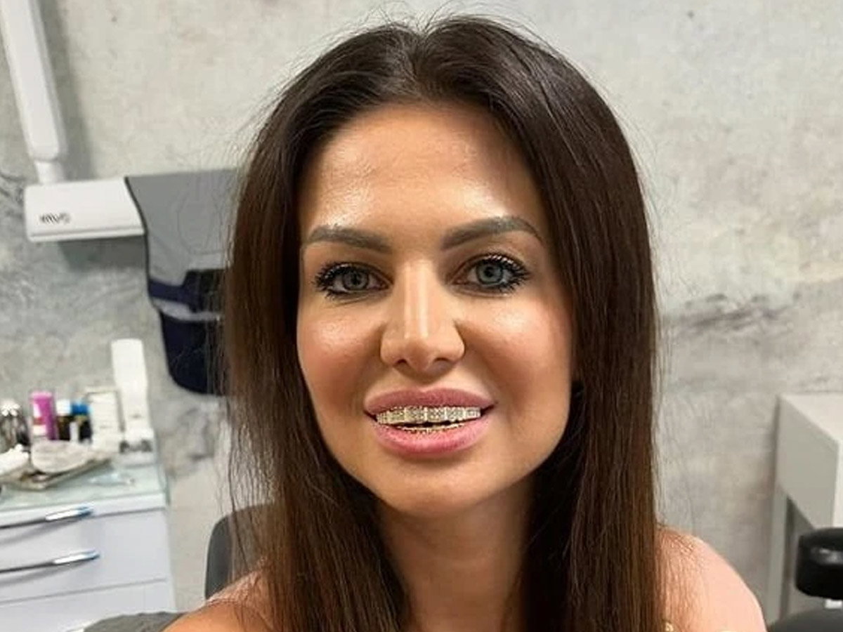Nowe zęby Mai Rutkowski