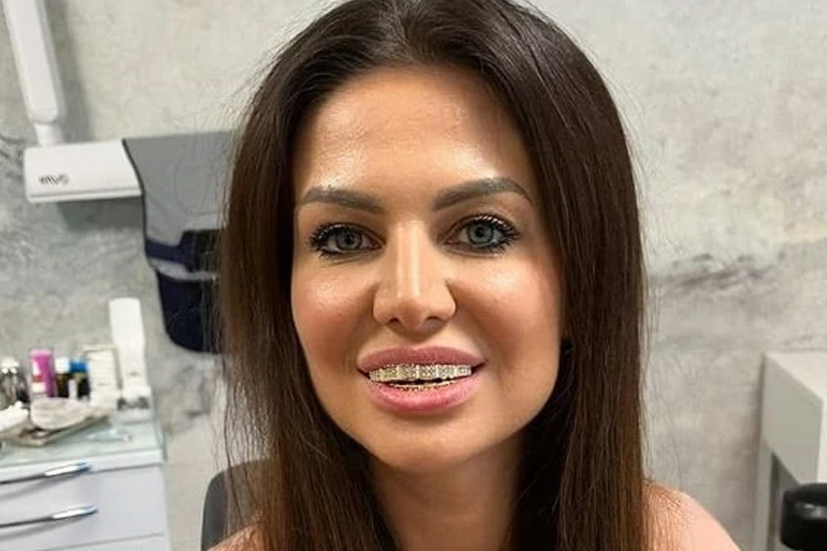 Nowe zęby Mai Rutkowski