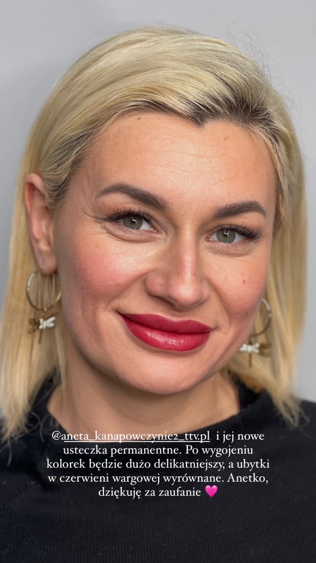 Nowe usta Anety z Kanapowczyń