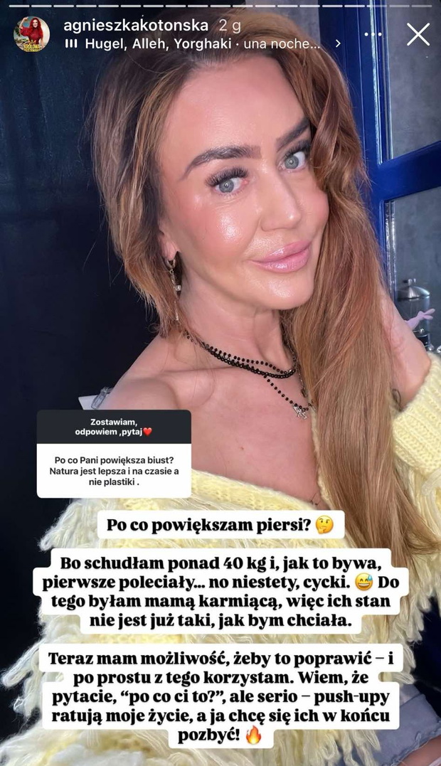 Agnieszka Kotońska chce powiększyć biust