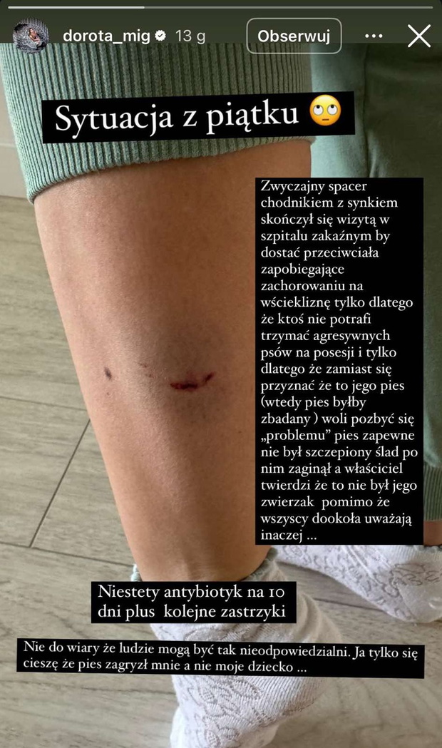 Gwiazda disco polo pogryziona przez psa
