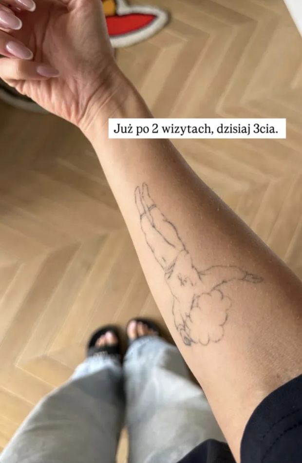 Martirenti usuwa tatuaże