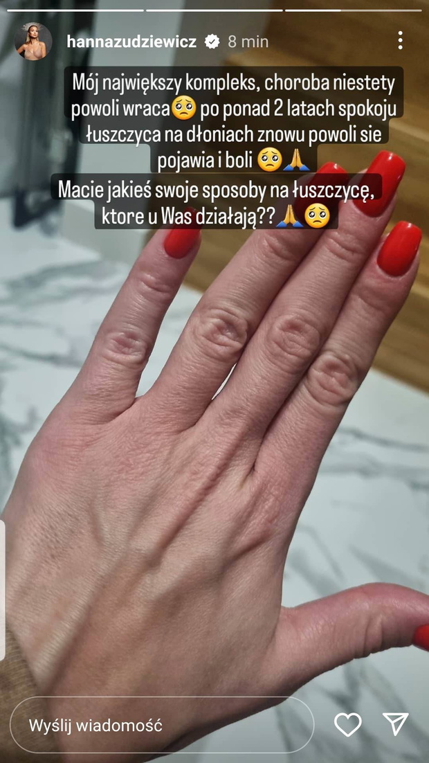 imgVb8sfs-ba0df1e