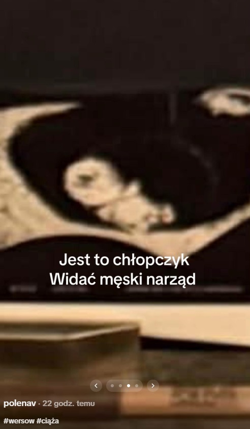 Wersow zdradziła przez przypadek płeć dziecka? Internauci zwrócili uwagę na jeden szczegół