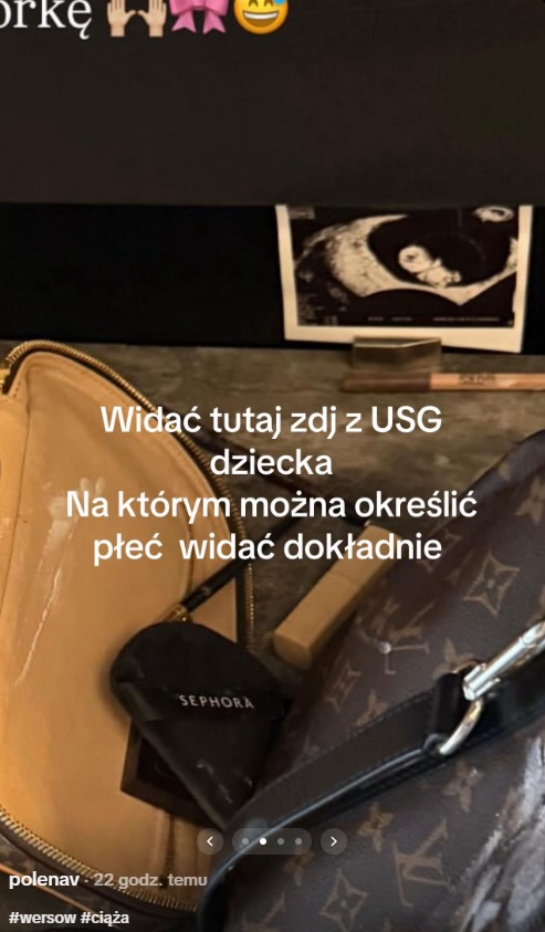 Wersow zdradziła przez przypadek płeć dziecka? Internauci zwrócili uwagę na jeden szczegół