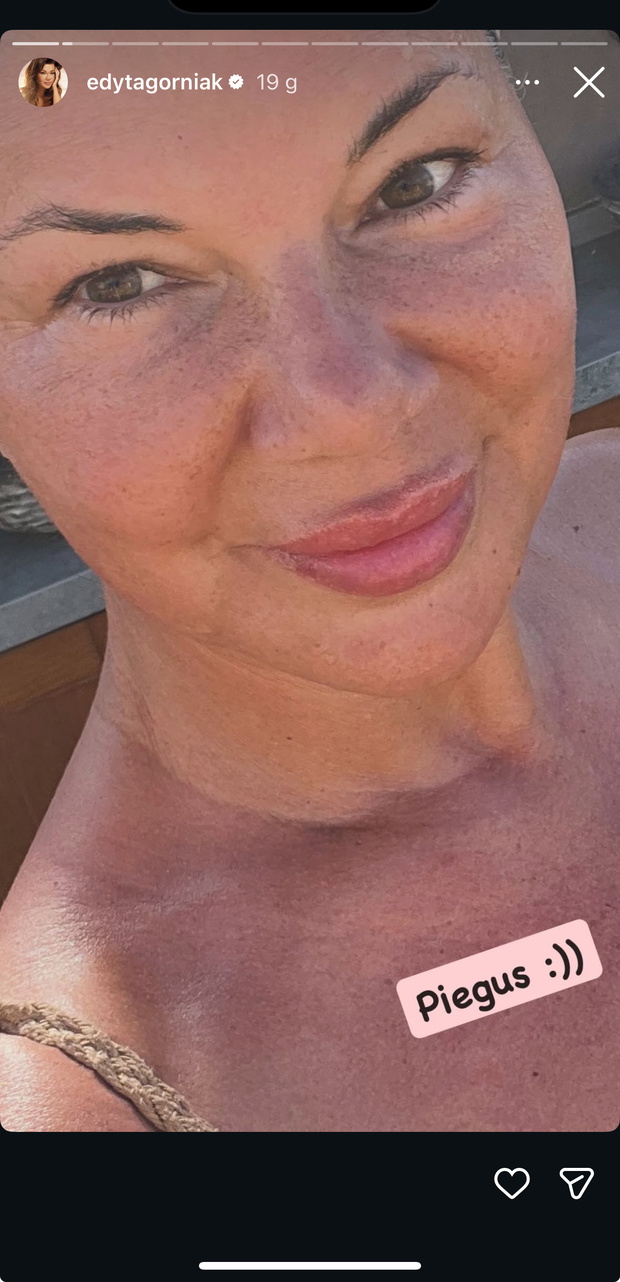 Edyta Górniak pokazuje piegi na cerze bez makijażu