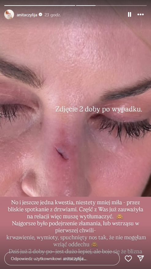 Anita ze "Ślubu od pierwszego wejrzenia" miała wypadek