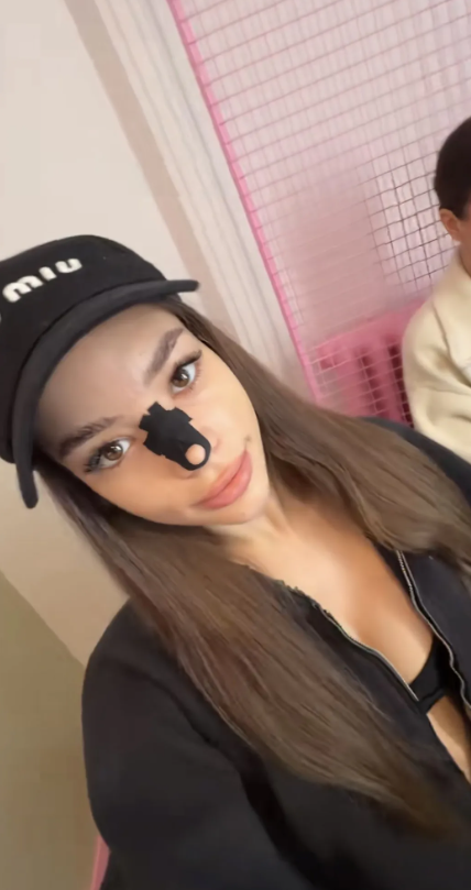 Sofi Sivokha z "Królowej przetrwania" pokazała nos po operacji fot. TikTok