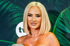 Izabela Macudzińska wprost o medycynie estetycznej. "Lubię eksperymentować ze swoim wizerunkiem" fot. Jacek Kurnikowski/AKPA
