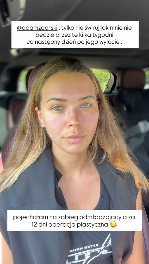 Sandra Kubicka pokazuje zaczerwienioną twarz po zabiegu