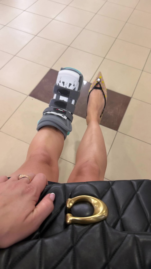 Anna Bardowska z "Rolnik szuka żony" ma kontuzję nogi