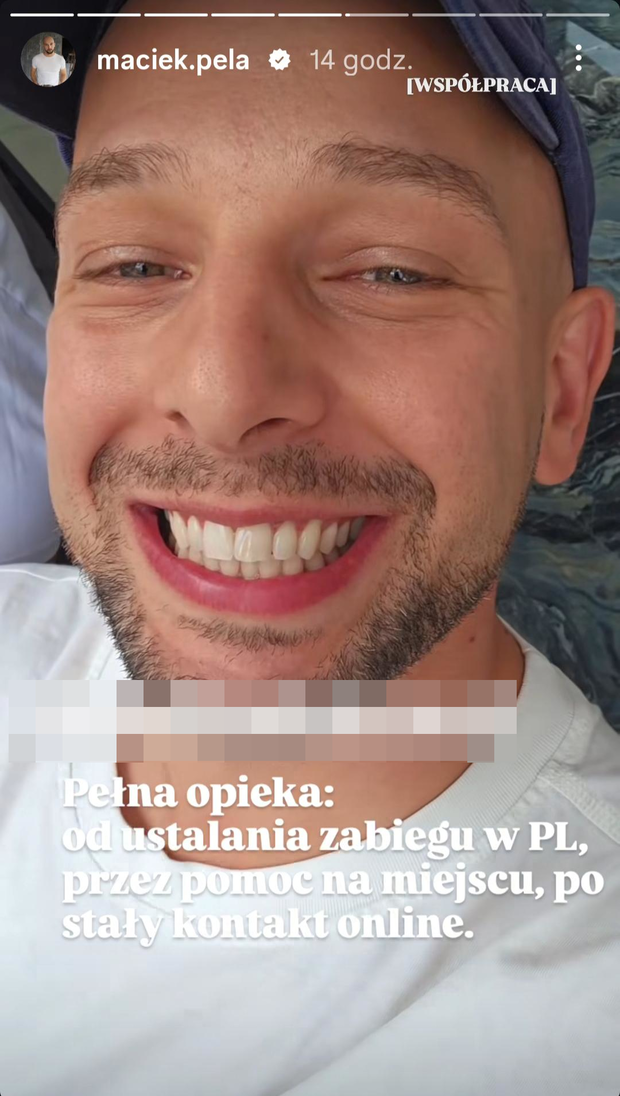 Maciej Pela zrobił sobie zęby w Turcji. Nie kryje radości. Pokazał efekty