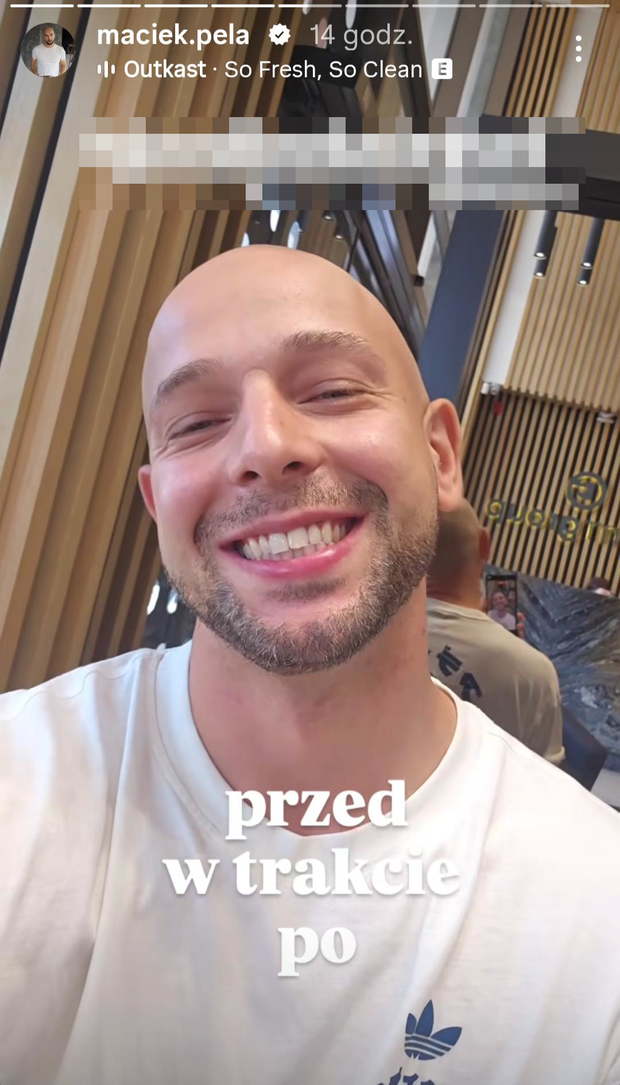 Maciej Pela zrobił sobie zęby w Turcji. Pokazał efekty