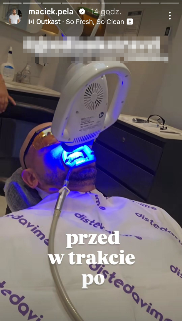 Maciej Pela zrobił sobie zęby w Turcji